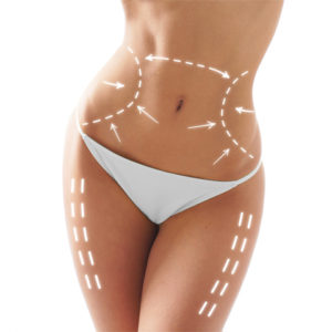 Body Contouring, New York City